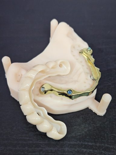 Blender titanio zirconio monolitico