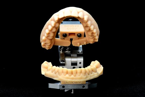 modelos 3d impresos articulados en articulador iTero