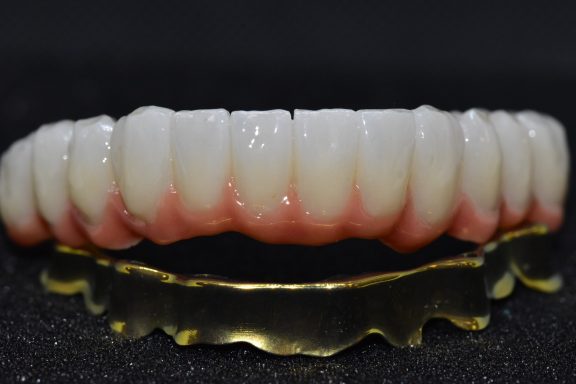 barra blender titanio con supraestructura de zirconio monolitico