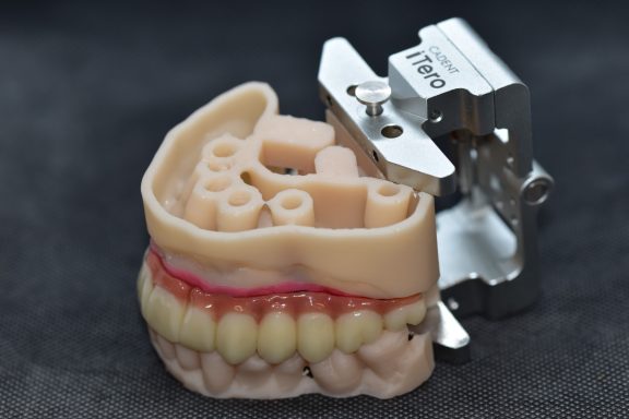 puente sobre implantes de zirconio monolitico con encia rosa