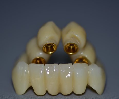 zirconio monolitico sobre interfases