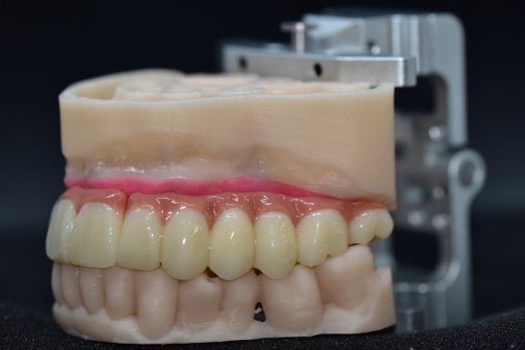 puentes de zirconio monolitico sobre implantes